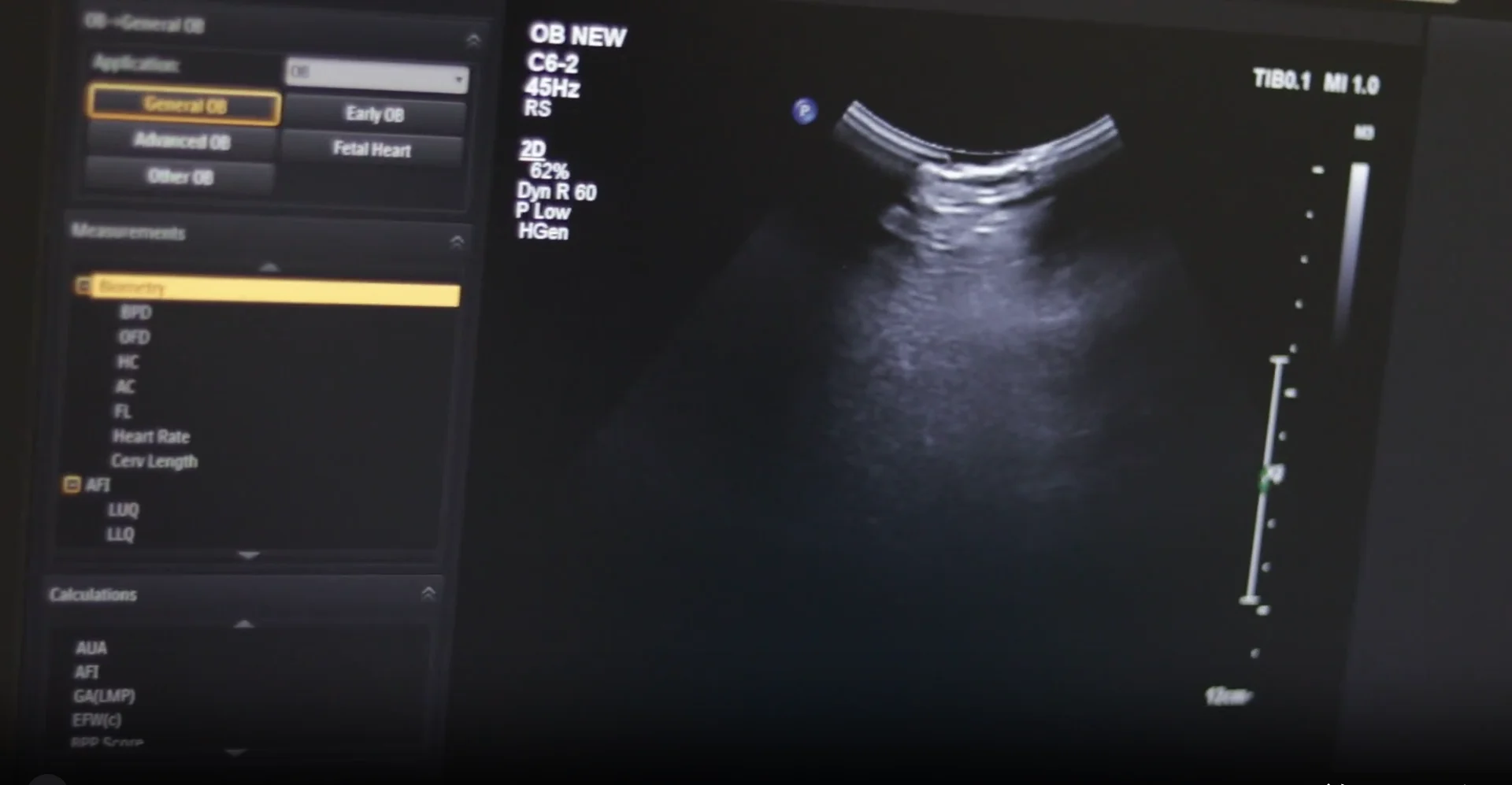 Echocardiogram Test in Guwahati